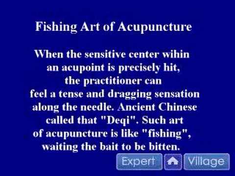 Akupunktur Geleneksel Çin Tıbbı Teknikleri: Akupunkturcu Farklı Sonuçlar: Geleneksel Çin Tıbbı