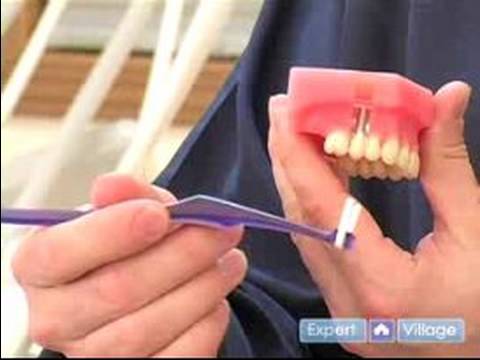 Nasıl Dişleri Sağlıklı Tutmak İçin: Dental İmplantlar Ağız Hijyeni İçin Temizlik