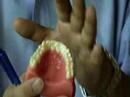 Diş Beyazlatma İpuçları Ve Teknikleri: Nasıl Beyazlatma Şeritler İş Kret