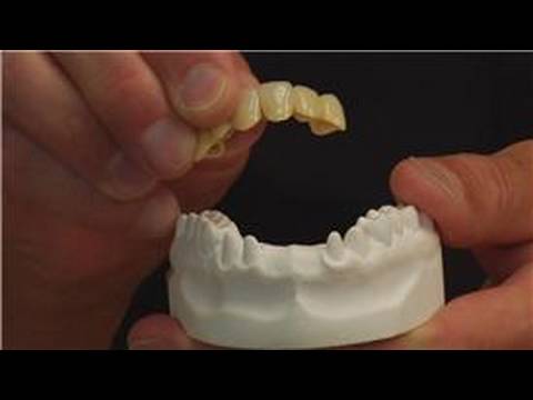 Takma Dişler Ve Takma Diş: Takma Diş Alternatifleri Resim 1