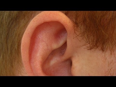 Eğer Kulak Kıkırdak Enfekte Olup Olmadığını Belirlemek | Kulak Problemleri