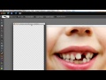 Adobe Photoshop Elements 10, 11 Sabitleme Çarpık Dişleri Photoshop Elements Resim 2