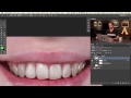 Nasıl Photoshop'ta Dişleri Beyazlatmak İçin Resim 3