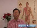 Akupunktur Geleneksel Çin Tıbbı Teknikleri: Akupunktur Donmuş Omuz İçin: Geleneksel Çin Tıbbı Resim 3