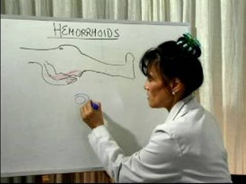 Nasıl Hemoroid Tedavi: Ne Nedenleri Hemoroid?