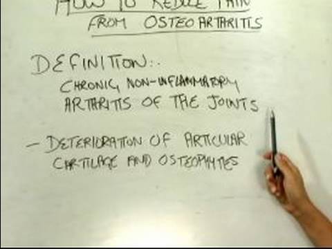 Nasıl Treat Osteoartrit Belirtileri: Osteoartrit Nedir? Resim 1