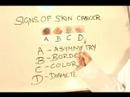 Nasıl Cilt Kanseri Tanımlamak İçin: Nasıl Deri Kanseri İşaretleri İçin Vücudunuzun İncelemek İçin Resim 4