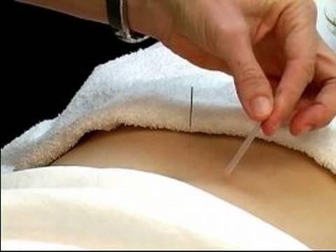 Akupunktur Ve Çin Tıbbı : Akupunktur Sindirim Ve Böbrek Puan Resim 1