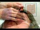Akupunktur Ve Çin Tıbbı : Akupunktur Dezenfektan İpuçları Resim 3