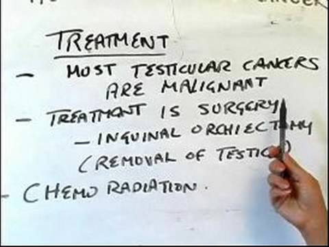 Nasıl Bir Testis Kanseri Muayenesi: Testis Kanseri İçin Tedavi Seçenekleri Resim 1