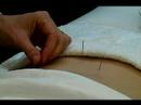 Akupunktur İle Ortak Rahatsızlıkları Tedavi : Akupunktur İle İdrar Sorunları Tedavi 