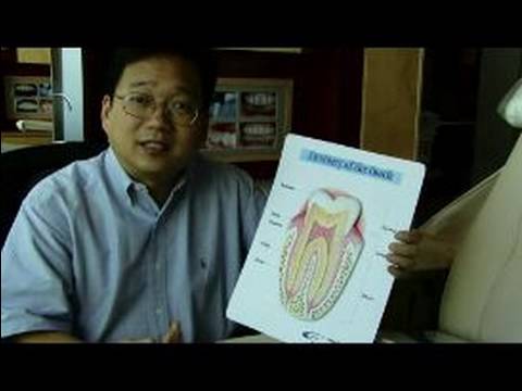 Diş Beyazlatma Ürünleri Ve Prosedürler: Ne Nedenleri Diş Lekeleri?