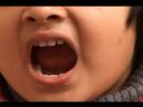 Bebek Diş Çıkarma Belirtileri Ve Yardım: Bebek Diş Çıkarma Belirtileri Ve Ağrı Tedavisi