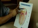Kanal Tedavisine İhtiyacım Var Mı? : Diş Kökleri Modeli  Resim 3