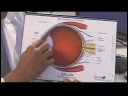 Glokom Belirtileri Ve Tedavisi : Göz Anatomisi 