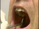 Diş Bakımı: Koronal Diş Parlatma : Koronal Diş Parlatma: Çift Kontrol Sonuçları Resim 4