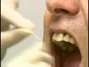 Diş Bakımı: Koronal Diş Parlatma : Koronal Diş Parlatma: Diş İpi Resim 4