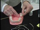Nasıl Diş Diş İpi: Nasıl Diş Diş İpi Resim 3