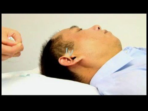 Akupunktur Detoksifikasyon İçin: Akupunktur İçin Kimyasal Denge Resim 1