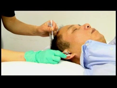 Akupunktur Detoksifikasyon İçin: Kulak Noktası İçin Akupunktur Resim 1