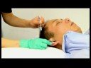 Akupunktur Detoksifikasyon İçin: Kulak Noktası İçin Akupunktur Resim 3