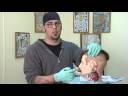 Piercing İpuçları Ve Tamamlayıcı Tedavi : Kulak Piercing İle Komplikasyonlar  Resim 3