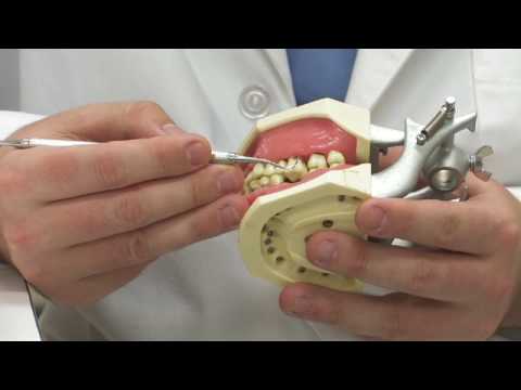 Diş Eti Hastalığı Tedavi Etmek İçin Nasıl Diş Sağlığı :  Resim 1