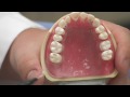 Diş Sağlığı : Diş Hekimi Bir Boşluğu Doldurmak Mı? Resim 4
