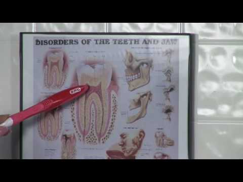 Sağlıklı Diş Bakımı : Diş Apex Nedir? Resim 1